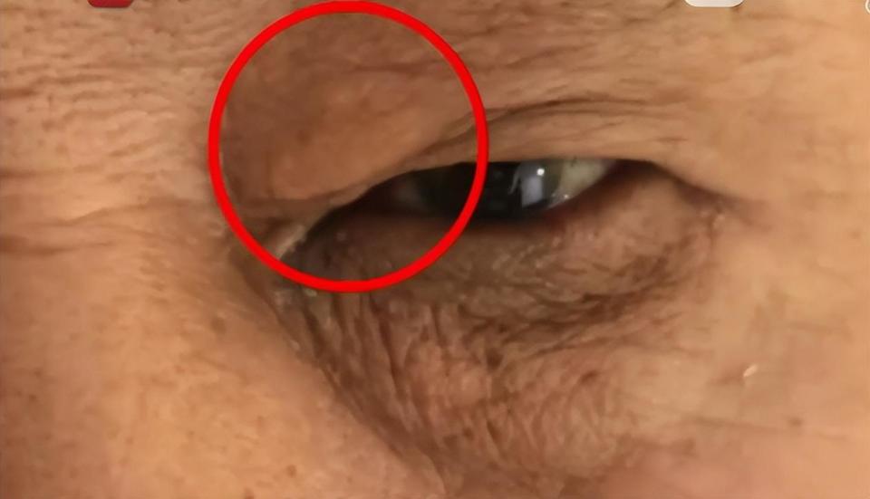  【深度科普】心血管隐匿风险排查与临床体征识别指南 健康养生